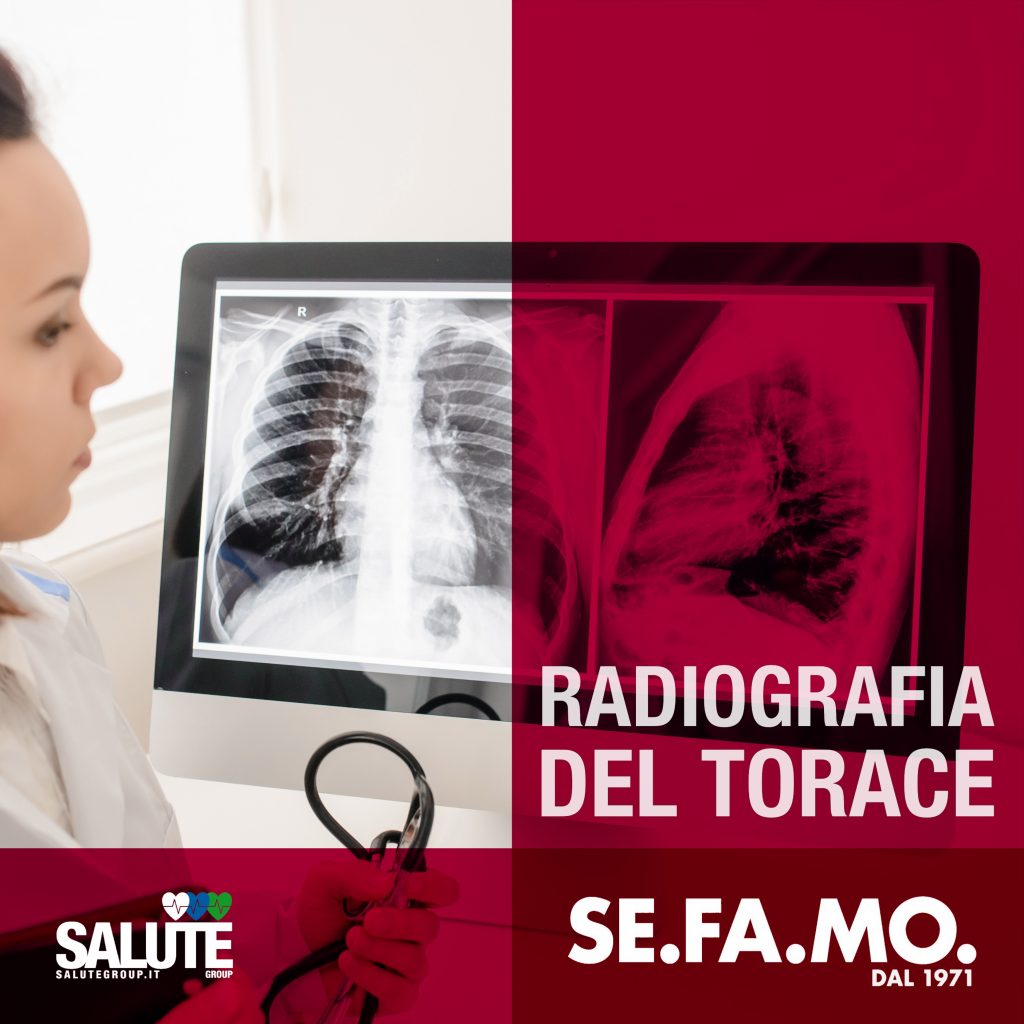 Radiografia del torace, lastre e raggi, FAQ