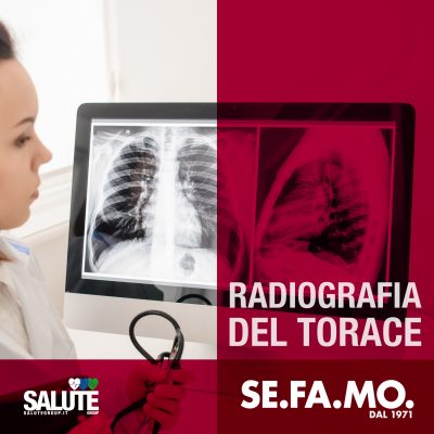 Radiografia del torace, lastre e raggi, FAQ