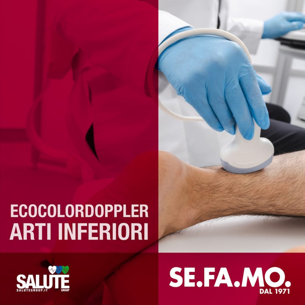 ecocolordoppler arti inferiori cosa sapere SE.FA.MO.