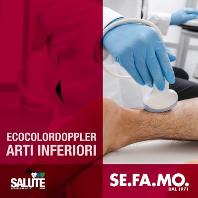 ecocolordoppler arti inferiori cosa sapere SE.FA.MO.